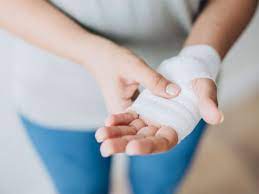 زخم چیست؟